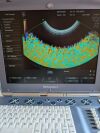 GE Voluson i Ultrasound - OB / GYN