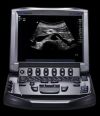 SONOSITE M-Turbo Ultrasound System