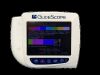 GLIDESCOPE 0570-0304 Monitor