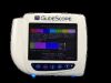 GLIDESCOPE 0570-0304 Monitor