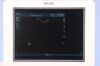PHILIPS HD15 Ultrasound - Shared Service