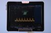 ESAOTE MyLabTwice HD Ultrasound - Shared Service
