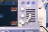 ALOKA Prosound 7 Ultrasound Machine
