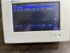 SPACELABS DM3 Monitor