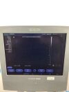 SIEMENS Acuson X300 Premium Edition 