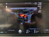 GE Voluson E10 OLED Ultrasound - Shared Service