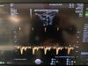 GE Voluson E10 OLED Ultrasound - Shared Service