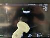 GE Voluson E10 OLED Ultrasound - Shared Service
