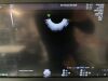 GE Voluson E10 OLED Ultrasound - Shared Service