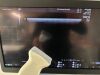 GE Voluson E10 OLED Ultrasound - Shared Service