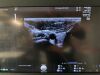 GE Voluson E10 OLED Ultrasound - Shared Service
