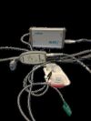 NATUS Algo 5 BORN HEARING SCREENER