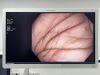 OLYMPUS Scope Model: PCF-H180AL Endoscope