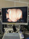 OLYMPUS CF-H180DL Endoscope