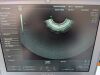 GE RIC5-9W-RS Ultrasound Transducer