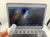 SONOSCAPE X3 Portable Ultrasound Scanner