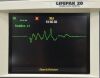 MEDTRONIC Lifepak 20 Defibrillator Monitor 3202487-015 W/ Paddles - 203602 Defibrillator