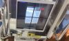 RALCO R221/A X-Ray Collimator Collimator - X-Ray