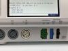GE 259CX-A Fetal Monitor