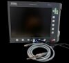 STORZ Telepack X LED TP100 Camera System with Light Cable O/R Camera