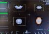 GE RIC5-9A-RS Ultrasound Transducer