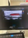 SAMSUNG RS80A Ultrasound - Shared Service