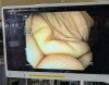 OLYMPUS CF-Q180AL Colonoscope
