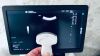 GE Logiq E10s 2020 with 3 probes ShareWave & 3D/4D Module General Ultrasound
