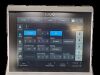 GE LOGIQ P9 R4.5 ULTRASOUND MACHINE W/ 3 PROBES, 4D, ADVANCED 3D