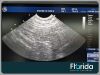 GE 2012 E8C ENDOCAVITARY PROBE TRANSDUCER PROBE REF 2297883 TESTED 30 DAYS WARRANTY Ultrasound Transducer