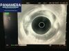 OLYMPUS GF-UE160-AL5 Gastroscope