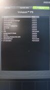 GE Voluson P8 Ultrasound - OB / GYN