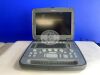 SIEMENS ACUSON P500 Portable Ultrasound System