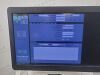 GE Logiq E9 2018   XDCLEAR 2.0 ULTRASOUND SYSTEM W/ 3 PROBES