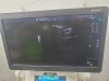 GE Logiq E9 2018   XDCLEAR 2.0 ULTRASOUND SYSTEM W/ 3 PROBES