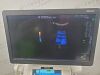 GE Logiq E9 2018   XDCLEAR 2.0 ULTRASOUND SYSTEM W/ 3 PROBES