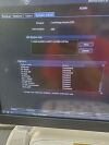 GE VIVID E95 ULTRASOUND MACHINE