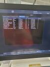 GE VIVID E95 ULTRASOUND MACHINE