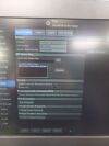 GE VERSANA  BALANCE VA ULTRASOUND MACHINE