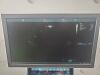 GE MEDICAL S GE-Vivid-S70N-Set Ultrasound - Cardiac - Vascular