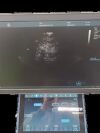 GE MEDICAL S GE-Vivid-S70N-Set Ultrasound - Cardiac - Vascular