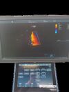 GE MEDICAL S GE-Vivid-S70N-Set Ultrasound - Cardiac - Vascular