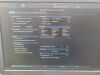 GE MEDICAL S GE-Vivid-S70N-Set Ultrasound - Cardiac - Vascular