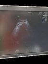 GE VOLUSON E8  BT18 ULTRASOUND MACHINE  4 PROBES