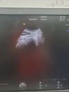 GE VOLUSON E8  ULTRASOUND MACHINE  2 PROBES