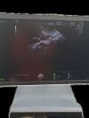 GE VOLUSON E8  ULTRASOUND MACHINE  2 PROBES