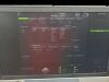 GE VOLUSON E8  ULTRASOUND MACHINE  2 PROBES