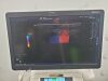 GE Logiq E9 2016   XDCLEAR 2.0 ULTRASOUND SYSTEM W/ 2 PROBES
