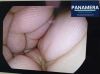 PENTAX EG-2790i Gastroscope