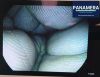 PENTAX EG-2790i Gastroscope
